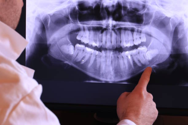 Best Emergency Cosmetic Dentistry in West Ocean City, MD