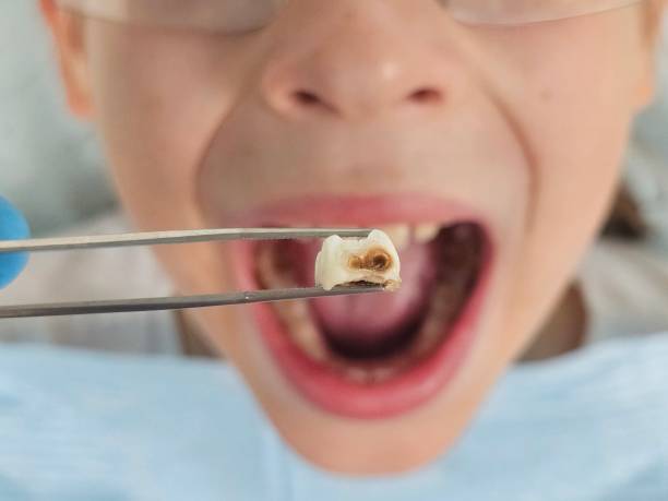 Best Mobile Emergency Dentist in West Ocean City, MD